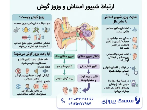 ارتباط شیپور استاش و وزوز گوش
